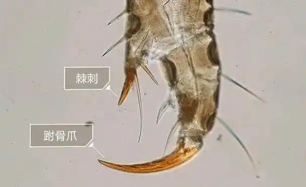 头虱是怎么长出来的(儿童头上的那个头虱怎么弄掉)-七暖网