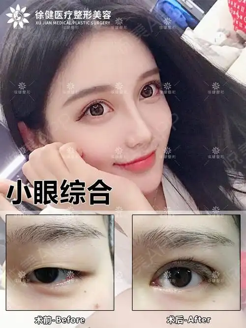 眼综合案例分享0002