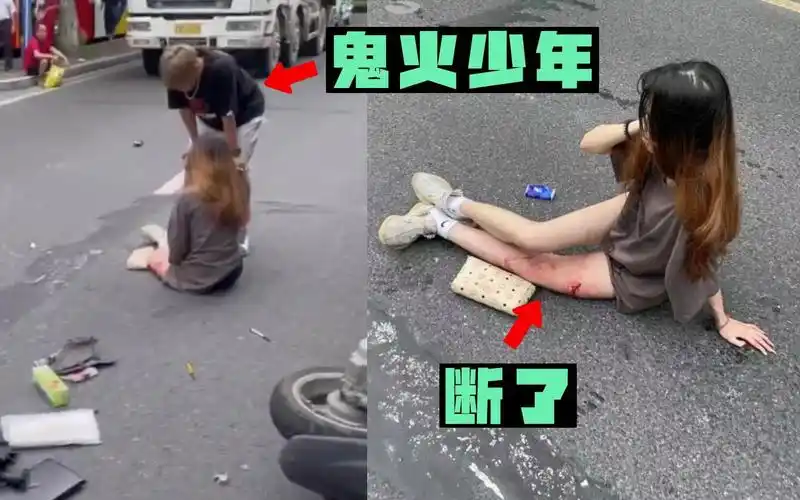 卧槽!鬼火少年酒驾逆行飙车,妹子腿当场断了