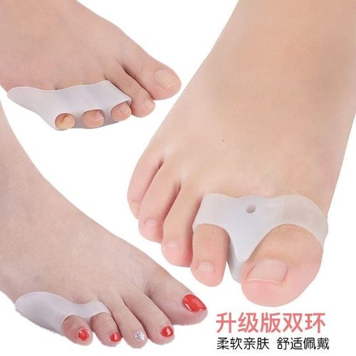 小脚趾矫正器重叠趾分趾器小拇指内外翻矫正器大脚骨分离器可穿鞋