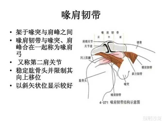 肩关节韧带及损伤mr表现(上)