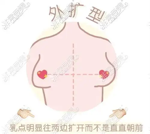 两胸之间多少厘米算外扩记住超过一掌长就是外扩