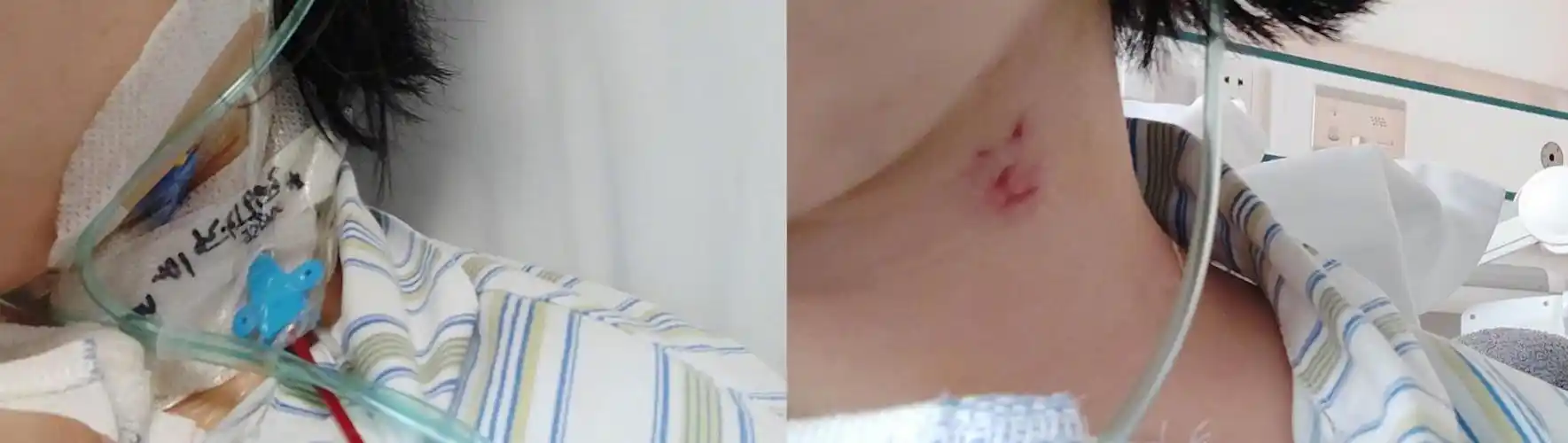 原以为要换个心脏零件,开胸之后我收到了意外的礼物|手术|心脏彩超