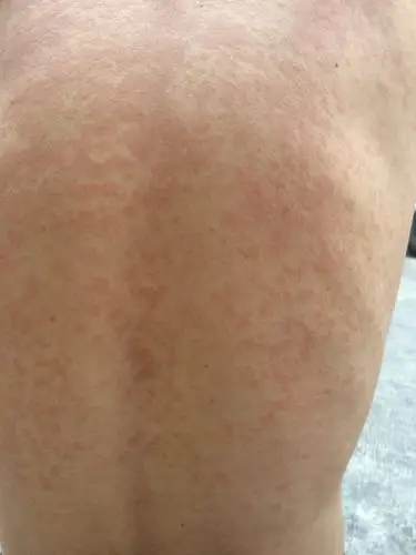 第一张是后背第二张是前面.