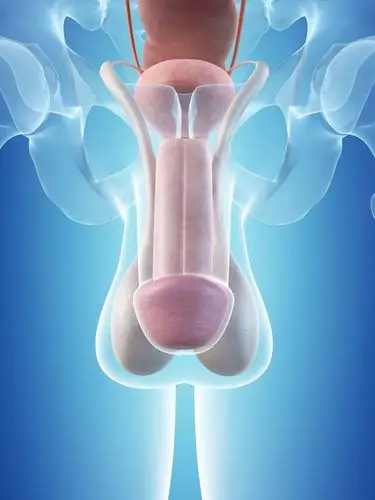 6 urological emergencies that can be treated