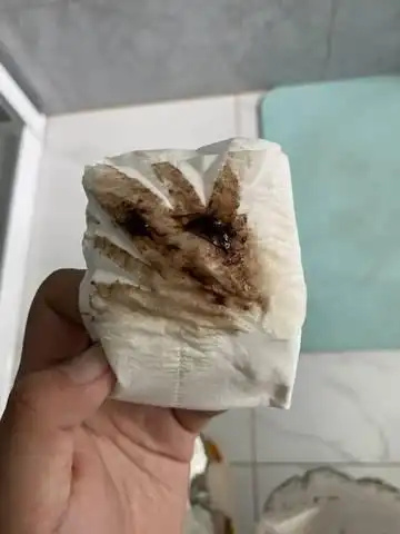 孕早期出血 上完厕所擦屁屁就出现血,会不会导致流产