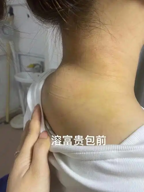 塑魔力溶脂富贵包消除术