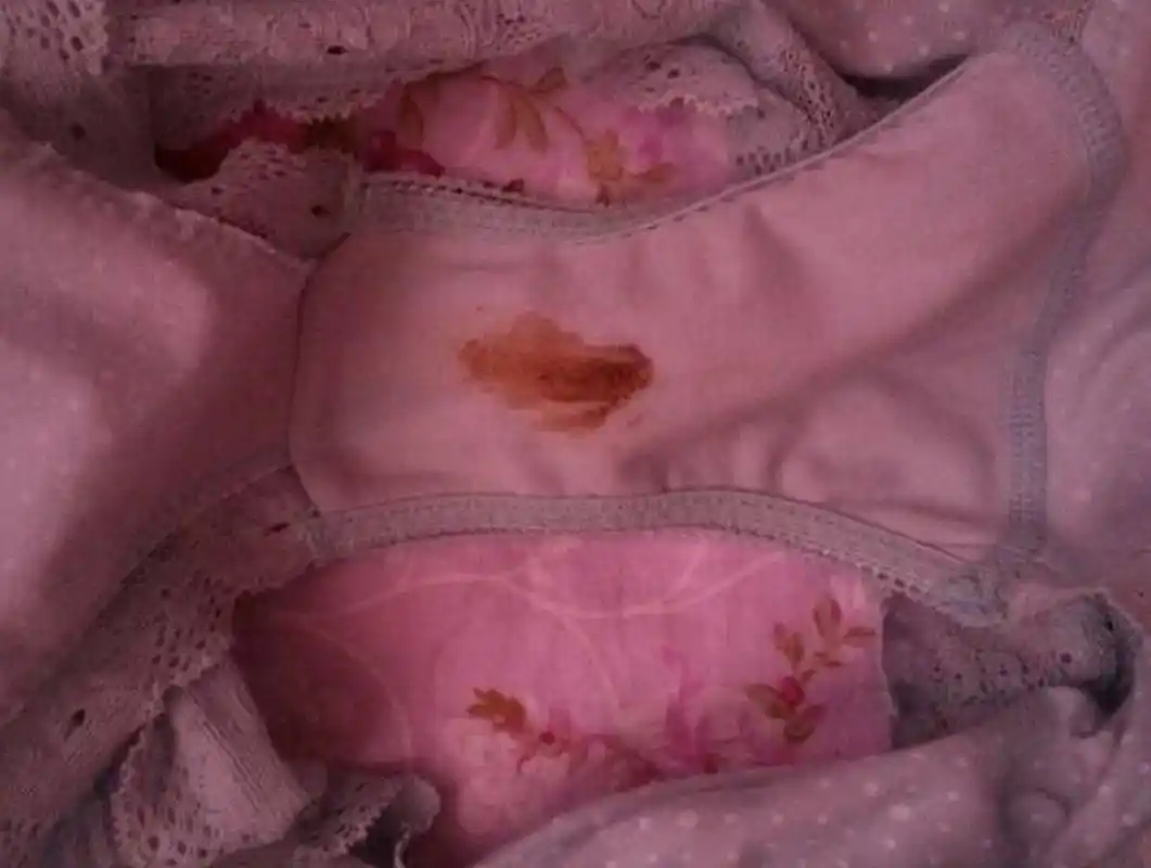 昨天她洗完澡后,我给她洗内裤时惊讶地发现了一点点血迹.