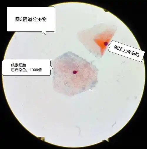 段师形态教学系列(第41期)_检验_细胞_医学