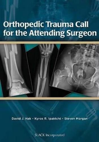 【预售】orthopedic trauma call for the attending surgeon