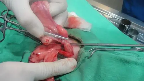 博爱就诊实录(内有几张手术照片)