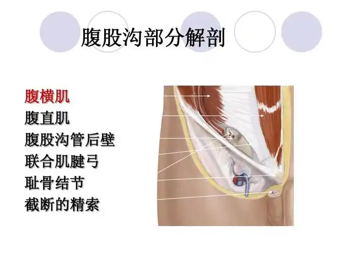腹股沟部分解剖 腹横肌 腹直肌 腹股沟管后壁 联合肌腱弓 耻骨结节