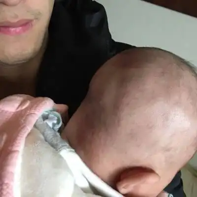 宝妈们,帮我看看,我家宝宝后脑勺怎麼这麼难看,而且还有一个包?