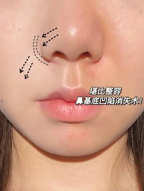 只用哑光高光教你如何提亮鼻基底巨简单