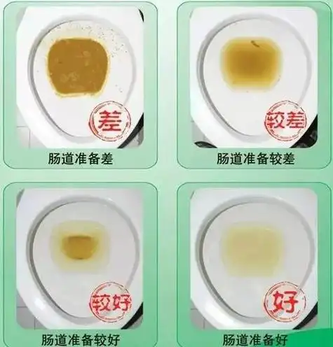 作为医生我最怕你做这件事做肠镜的患者千万要注意