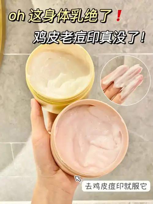 去鸡皮一绝后背长痘闭眼入早用早轻松