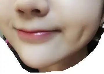 人造酒窝可以保持多久让你笑容更甜美