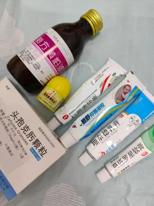 开了头孢克肟颗粒和莫匹罗星软膏,自己去药店买了复方黄柏液涂剂湿敷