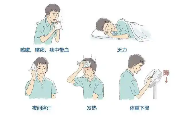 耐多药结核病的症状与普通结核病大致相同 主要有: 咳嗽, 咳痰, 痰中