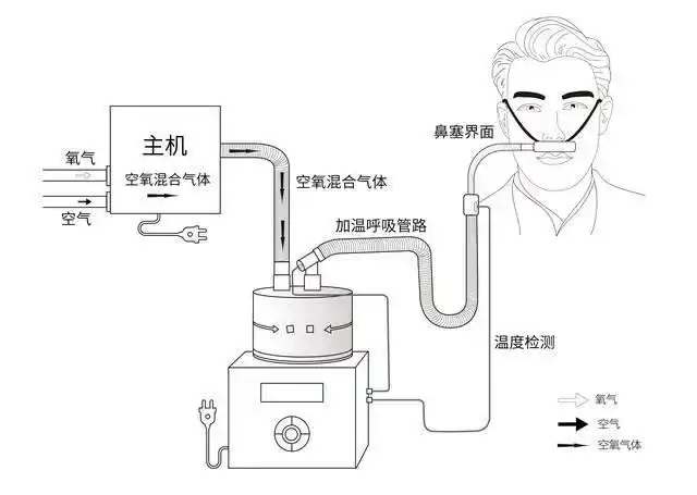 家庭氧疗和无创呼吸机有什么区别这些你必须了解