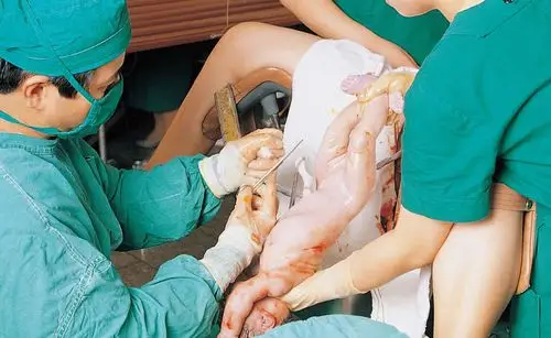 顺产生孩子时,产妇这些行为真的很讨厌,妇产科医生:敢怒不敢言