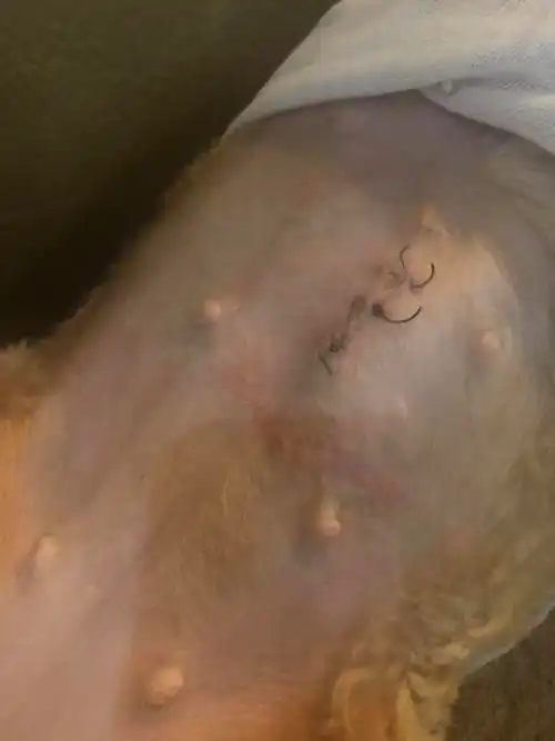 【讨论】绝育手术第7天 伤口这样是正常的吗