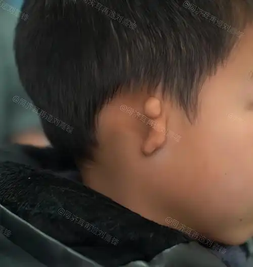 这个孩子八岁,家里三代人都健健康康,可是孩子一出生却没有右耳,家里