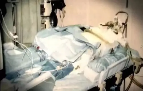 被核辐射才是最痛苦的死亡方式!