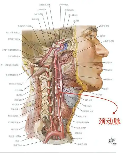 不小心得了颈动脉斑块?担心中风?处理竟然如此简单