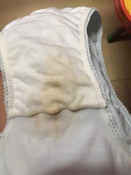 今天37周6天,早上内裤上出现这样的情况,是要发动了吗?