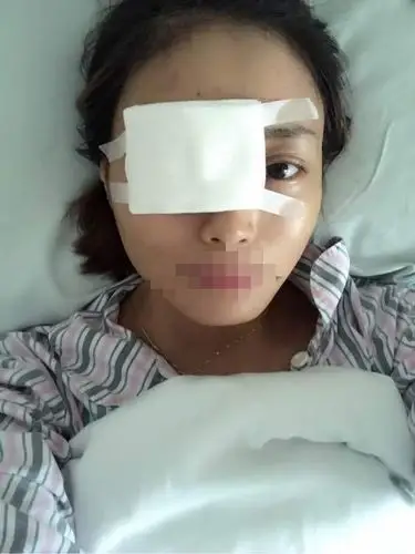 没有很疼,有点酸胀,做完之后不做任何检查眼睛打上绷带就出了手术室