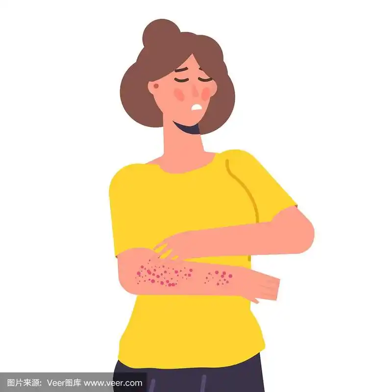皮肤瘙痒症状.女人抓手臂矢量插图.