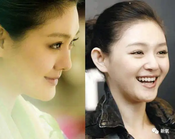 嘴还是那个嘴,下颌线,甚至全脸的紧致度说上去就上去了.