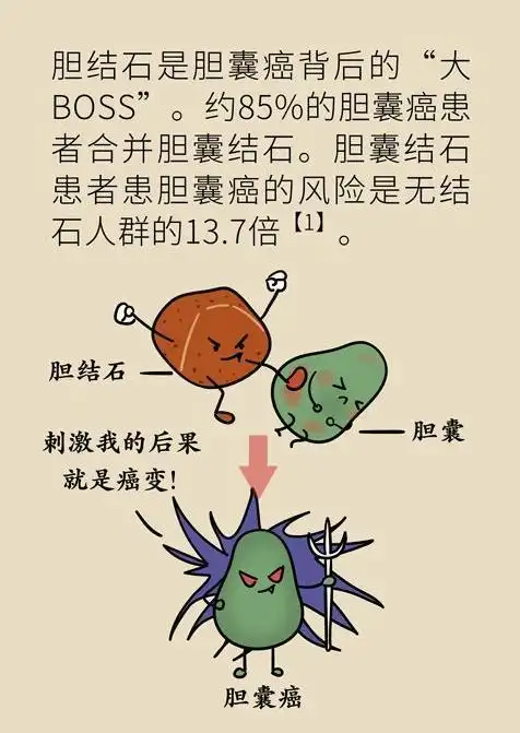 浑身疼痛不知道原因?胆结石真要注意,这个好方法能帮到你