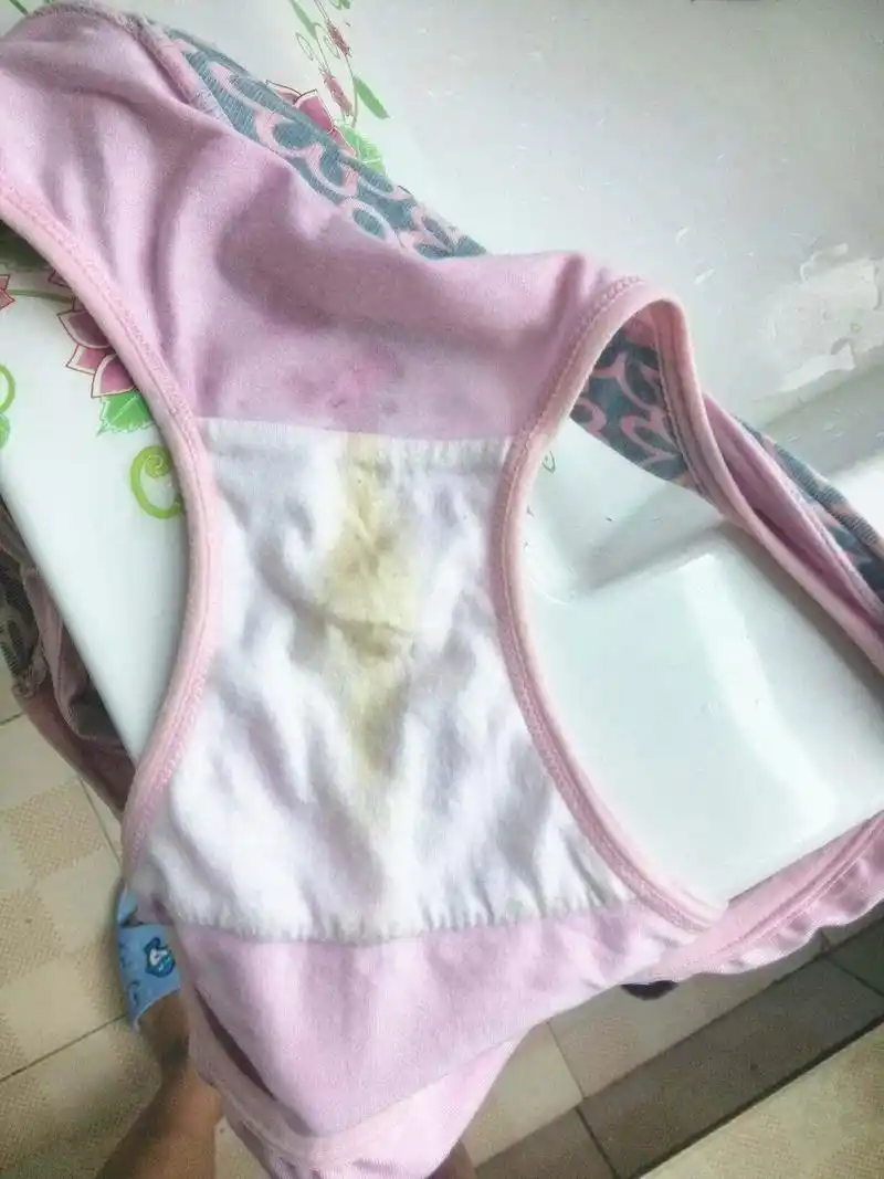 5岁女童内裤突现分泌物,只因爸爸这个偷懒举动,家长们要留意了