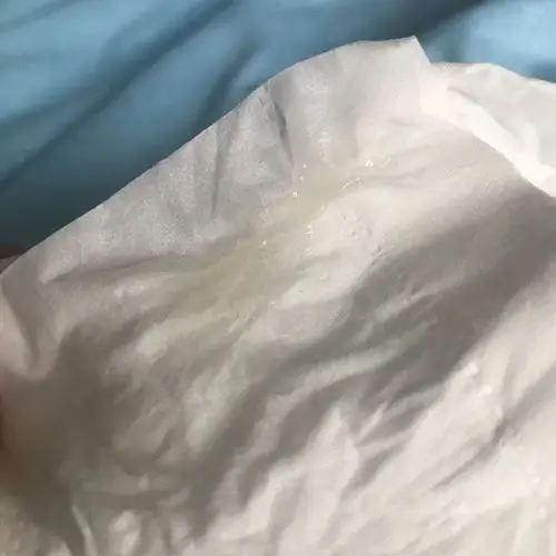 排卵期正常白带是什么样的?