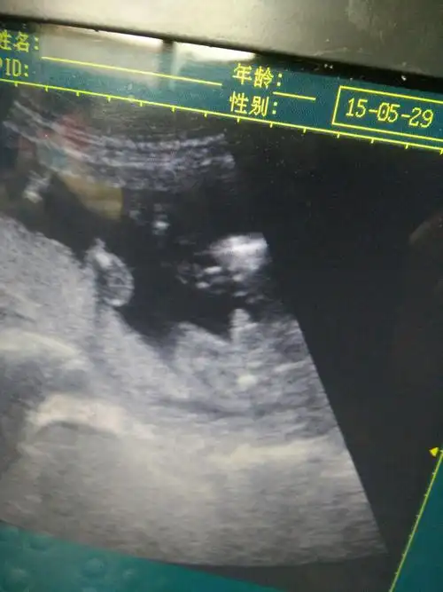 如愿了.宝妈们看看男宝图片供参考吧!