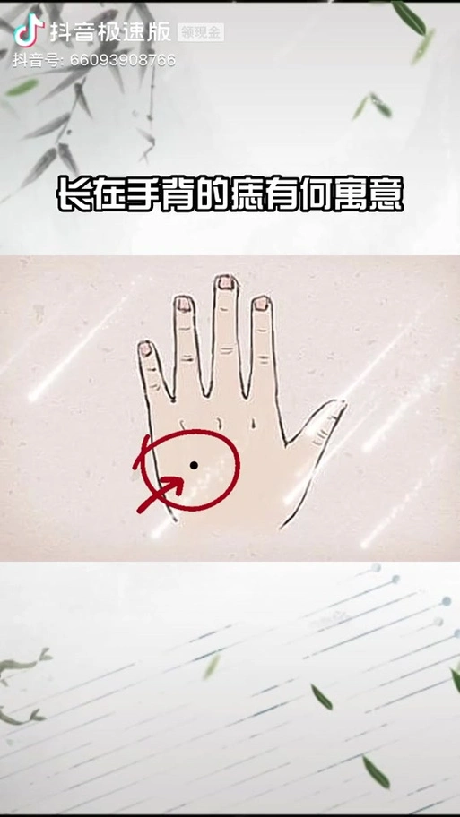 左手手背上长痣代表什么 - 抖音