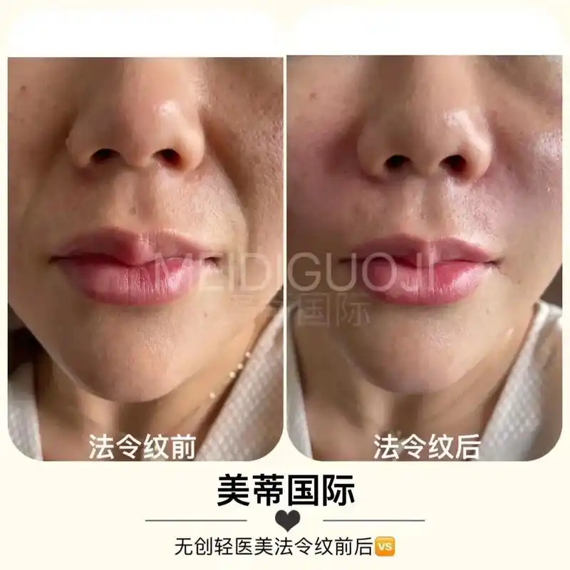 [玫瑰][玫瑰] 美蒂国际延安分公司案例分享[嘿哈] 补发昨 - 抖音