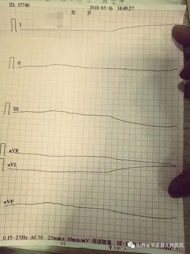 与死神对抗创造生命奇迹