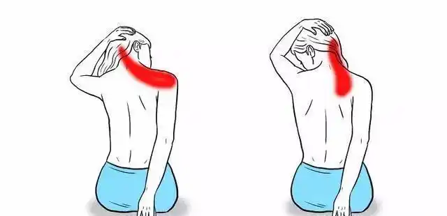 天鹅颈是每个女孩子都想拥有的,但想拥有天鹅颈,得先消除斜方肌