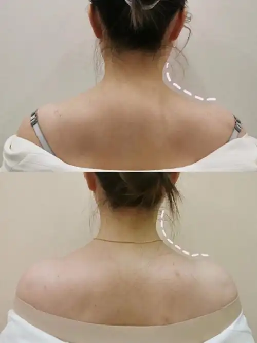 直到今天,拍照片对比发现还是瘦了的,有点小开心～所以赶紧过来分享