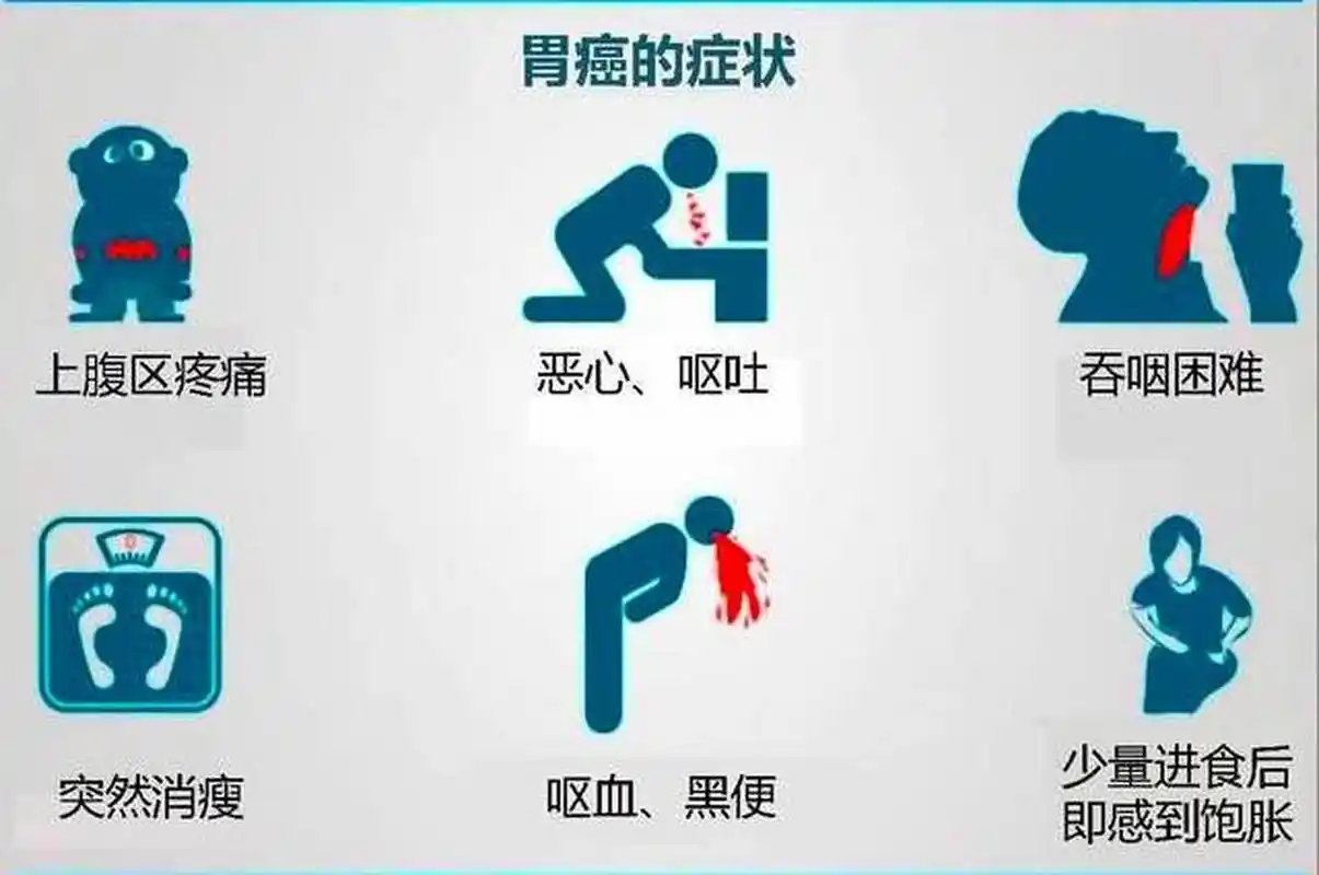 1,上腹疼痛饱胀,这是胃癌最常见的症状.