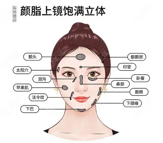 发表关于太原做脂肪填充面部医院排名及填充脸部都什么价位的内容