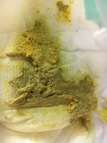 我宝宝今天出生第9天,基本上都是母乳喂养,一天下来可能会吃个60荷