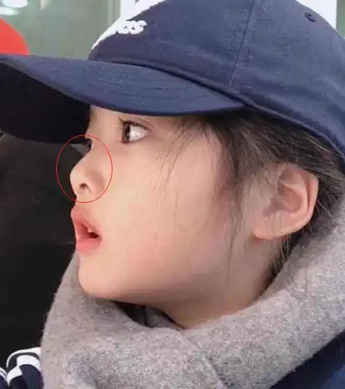 全网最火表情包和林妙可小时候一样的塌鼻梁宽眼距可她逆袭了