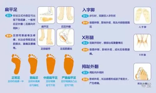 怎样判断儿童有扁平足现象及其影响