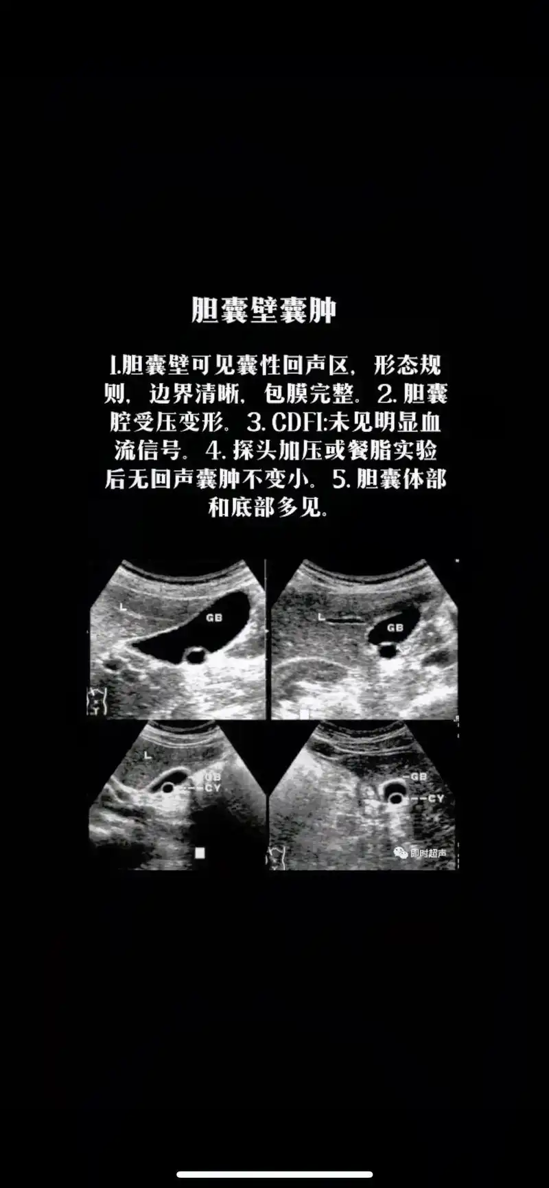 胆囊憩室与胆囊壁囊肿区别#超声学习 - 抖音