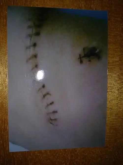 学生被捅伤,开江县讲治中学有责任吗