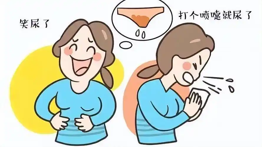 一条"小吊带"解决压力性尿失禁,为她成功摆脱"社交癌"_治疗_患者_尿道